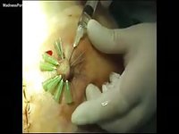 Extreme nipple piercing and abuse in this bizarre amateur fetish movie in the doctors office