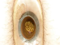  worms inside