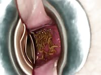   speculum debt payoff