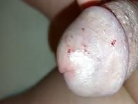 wasp stings cock pervers extrem 2