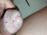 wasp stings cock pervers extrem 3