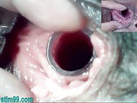 Lesbians Extreme Cervix Play and Peehole Fucking Penis Dildo