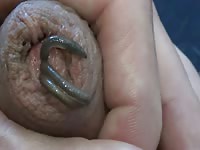Wurm im Pimmel